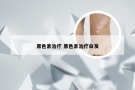 黑色素治疗 黑色素治疗白发