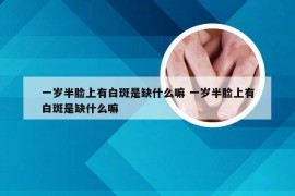 一岁半脸上有白斑是缺什么嘛 一岁半脸上有白斑是缺什么嘛