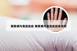 银屑病与变态反应 银屑病与变态反应有关吗