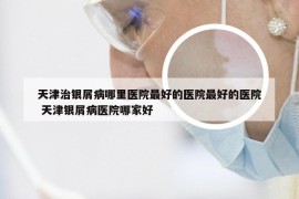 天津治银屑病哪里医院最好的医院最好的医院 天津银屑病医院哪家好