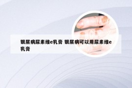 银屑病尿素维e乳膏 银屑病可以用尿素维e乳膏