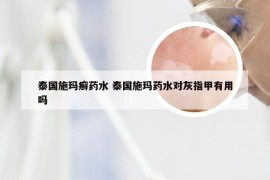 泰国施玛癣药水 泰国施玛药水对灰指甲有用吗