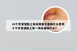 10个月宝宝脸上有白斑是不是缺什么营养 十个月宝宝脸上有一块白是缺什么?