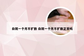 白斑一个月不扩散 白斑一个月不扩散正常吗