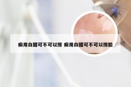 癣用白醋可不可以擦 癣用白醋可不可以擦脸