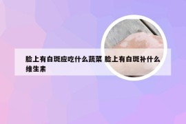 脸上有白斑应吃什么蔬菜 脸上有白斑补什么维生素