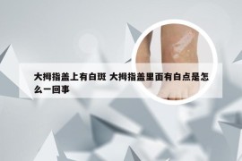 大拇指盖上有白斑 大拇指盖里面有白点是怎么一回事