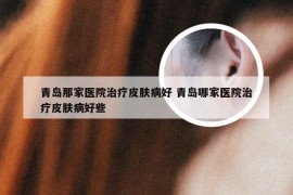 青岛那家医院治疗皮肤病好 青岛哪家医院治疗皮肤病好些