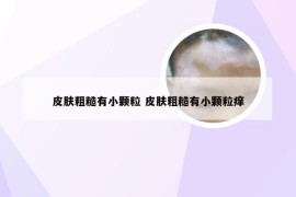 皮肤粗糙有小颗粒 皮肤粗糙有小颗粒痒