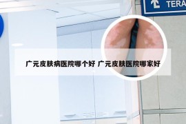 广元皮肤病医院哪个好 广元皮肤医院哪家好