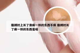 胳膊肘上长了像癣一样的东西不痒 胳膊肘长了癣一样的东西是啥