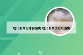 吃什么白班才会消失 吃什么白斑可以消失