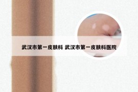 武汉市第一皮肤科 武汉市第一皮肤科医院