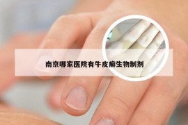 南京哪家医院有牛皮癣生物制剂