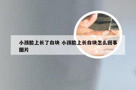 小孩脸上长了白块 小孩脸上长白块怎么回事图片