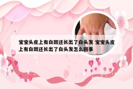 宝宝头皮上有白斑还长出了白头发 宝宝头皮上有白斑还长出了白头发怎么回事