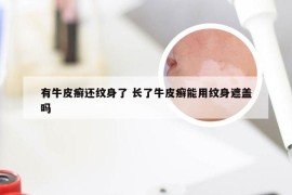 有牛皮癣还纹身了 长了牛皮癣能用纹身遮盖吗