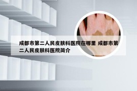 成都市第二人民皮肤科医院在哪里 成都市第二人民皮肤科医院简介