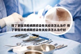 得了掌指浓疱病跟感染有关应该怎么治疗 得了掌指浓疱病跟感染有关应该怎么治疗好