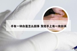 手有一块白是怎么回事 发现手上有一块白块