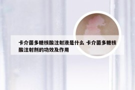 卡介菌多糖核酸注射液是什么 卡介菌多糖核酸注射剂的功效及作用