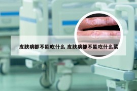 皮肤病都不能吃什么 皮肤病都不能吃什么菜