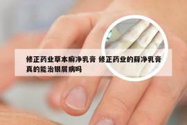 修正药业草本癣净乳膏 修正药业的藓净乳膏真的能治银屑病吗