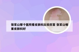 张家口那个医院看皮肤科比较厉害 张家口哪里皮肤科好
