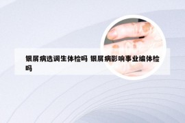 银屑病选调生体检吗 银屑病影响事业编体检吗