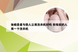 体癣患者与他人公用洗衣机好吗 和有藓的人用一个洗衣机