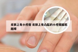 皮肤上有小疙瘩 皮肤上有凸起的小疙瘩越抓越痒