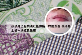 孩子身上起的浅红色像癣一样的东西 孩子身上长一块红色像癣