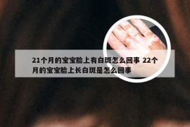 21个月的宝宝脸上有白斑怎么回事 22个月的宝宝脸上长白斑是怎么回事
