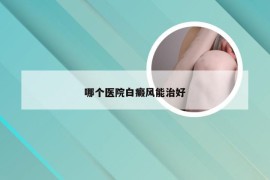 哪个医院白癜风能治好