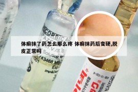 体癣抹了药怎么那么疼 体癣抹药后变硬,脱皮正常吗