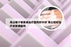 海口哪个银屑病治疗医院好不好 海口较好治疗皮肤病医院
