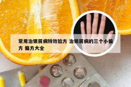 常用治银屑病特效验方 治银屑病的三个小偏方 偏方大全