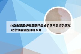 北京市银屑病哪里医院最好的医院最好的医院 北京银屑病医院哪家好
