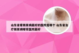 山东省看银屑病最好的医院是哪个 山东省治疗银屑病哪家医院最好