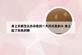 身上长癣怎么办白色的一大片红色的小 身上起了白色的癣