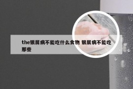 the银屑病不能吃什么食物 银屑病不能吃那些