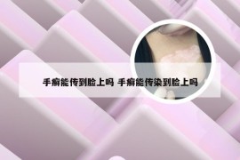 手癣能传到脸上吗 手癣能传染到脸上吗