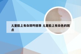 儿童脸上有白斑咋回事 儿童脸上有白色的斑点