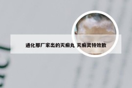 通化那厂家出的灭癣丸 灭癣灵特效散