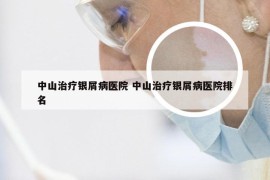 中山治疗银屑病医院 中山治疗银屑病医院排名