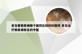 青岛看银屑病哪个医院比较好的医院 青岛治疗银屑病有名的中医