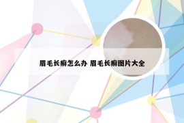 眉毛长癣怎么办 眉毛长癣图片大全