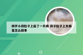 四岁小孩肚子上起了一片癣 孩子肚子上长癣是怎么回事