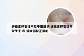纤维素样变性不见于银屑病 纤维素样变性常发生于 和 病变部位正常的