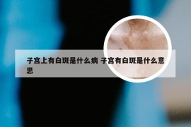 子宫上有白斑是什么病 子宫有白斑是什么意思